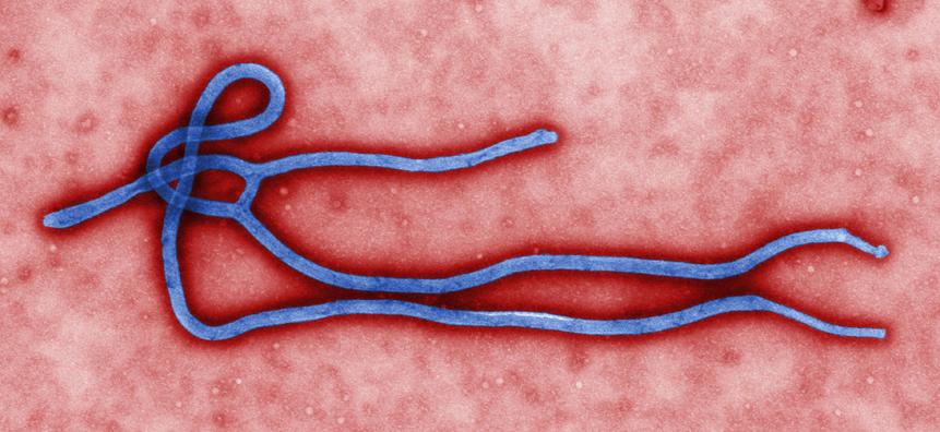 A microscopic view of the Ebola virus.